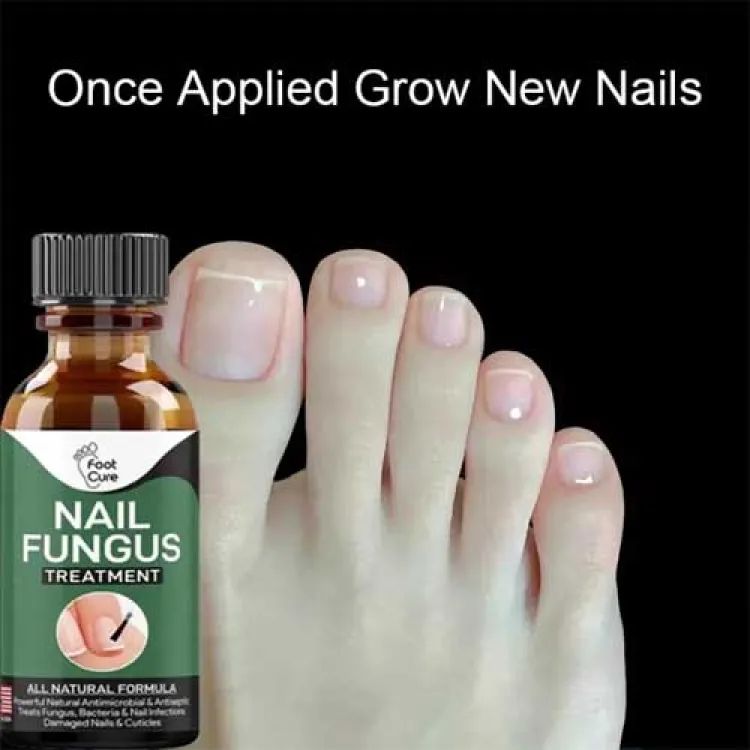 Nail Fungus Treatment Serum – Fast-Acting, All-Natural Nail Repair for Fingers & Toenails