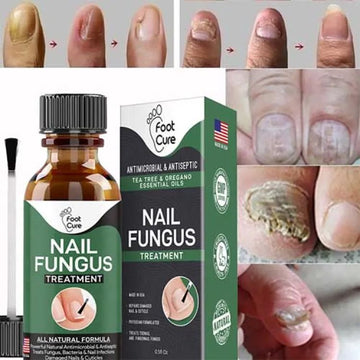Nail Fungus Treatment Serum – Fast-Acting, All-Natural Nail Repair for Fingers & Toenails